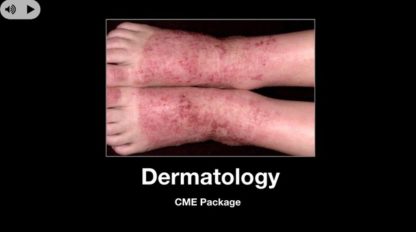 Dermatology CME Package with Amazon or Apple Gift Card